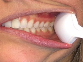 Bottom Teeth