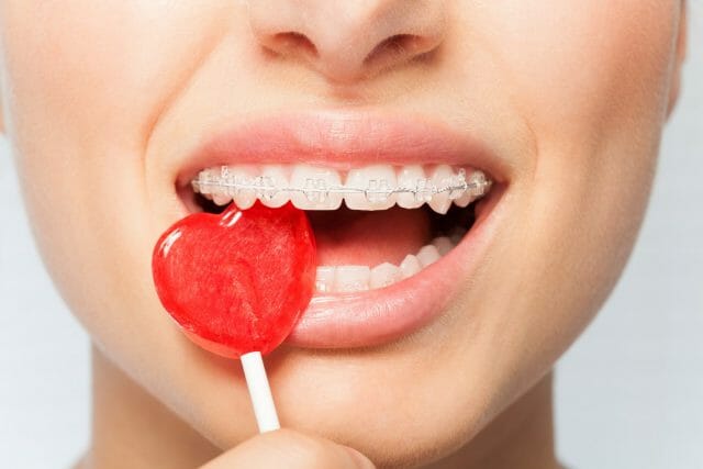 Woman with braces chewing on lollipop