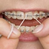 Flossing braces