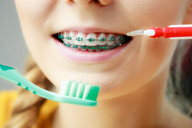 How to use Superfloss with fixed braces. 